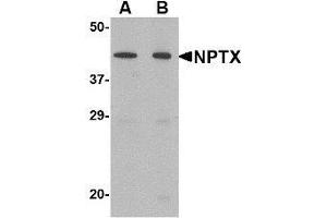 Western blot analysis of NPTX2 in mouse brain tissue lysate with NPTX2 antibody at (A) 0. (NPTX2 antibody  (Center))