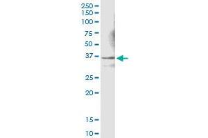 Immunoprecipitation of LDHC transfected lysate using anti-LDHC MaxPab rabbit polyclonal antibody and Protein A Magnetic Bead , and immunoblotted with LDHC MaxPab mouse polyclonal antibody (B01) . (Lactate Dehydrogenase C antibody  (AA 1-332))