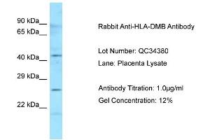 Host: Rabbit Target Name: HLA-DMB Sample Type: Human Placenta Antibody Dilution: 1. (HLA-DMB antibody  (N-Term))