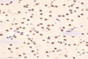 Immunohistochemistry analysis of paraffin-embedded mouse hippocampus using DAZAP1 (ABIN7073691) at dilution of 1: 6000 (DAZAP1 antibody)
