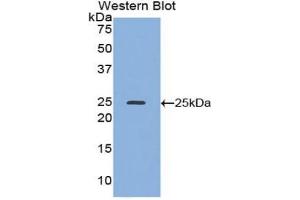 Detection of Recombinant ADH1, Mouse using Polyclonal Antibody to Alcohol Dehydrogenase 1 (ADH1) (ADH1 antibody  (AA 25-228))