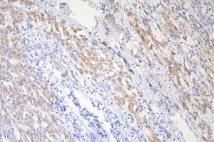 IHC analysis of TSC2 using anti-TSC2 antibody (ABIN7600203). (Tuberin antibody  (AA 1611-1807))