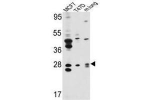 Image no. 1 for anti-E74-Like Factor 5 (Ets Domain Transcription Factor) (ELF5) (Middle Region) antibody (ABIN452951) (ELF5 antibody  (Middle Region))