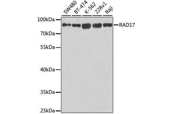 RAD17 抗体  (AA 391-670)