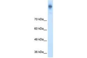 Image no. 1 for anti-Solute Carrier Family 12 (Potassium-Chloride Transporter) Member 2 (SLC12A2) (AA 1101-1150) antibody (ABIN205009) (SLC12A2 antibody  (AA 1101-1150))