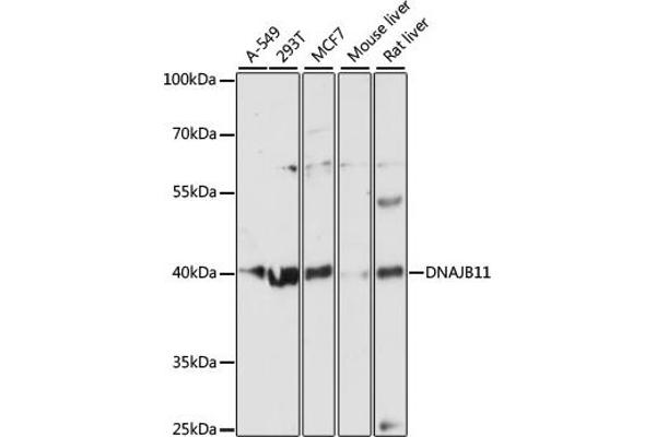 DNAJB11 antibody  (AA 89-358)