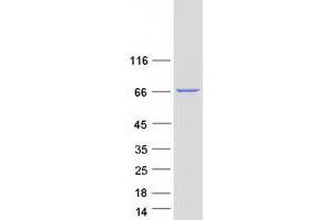 Validation with Western Blot