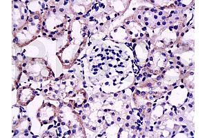 Formalin-fixed and paraffin embedded: rat kidney tissue labeled with Anti-fg-12 Polyclonal Antibody (ABIN727785), Unconjugated at 1:200, followed by conjugation to the secondary antibody and DAB staining (FGL2 antibody  (AA 75-150))