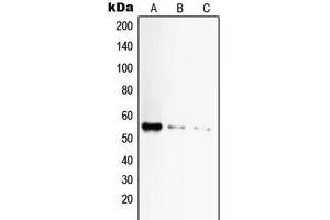 Western blot analysis of CD120a expression in HeLa (A), mouse liver (B), rat liver (C) whole cell lysates. (TNFRSF1A antibody  (C-Term))