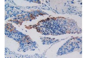 Figure. (c-MET antibody  (AA 1092-1379))