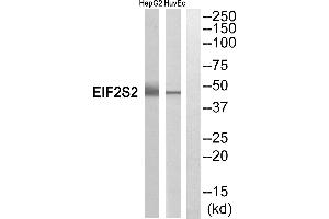 Western blot analysis of extracts from HepG2 cells and HuvEc cells, using EIF2S2 antibody. (EIF2S2 antibody  (Internal Region))