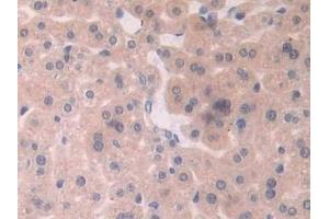 Detection of XDH in Mouse Liver Tissue using Polyclonal Antibody to Xanthine Dehydrogenase (XDH)
