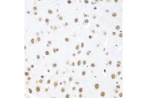 Immunohistochemistry of paraffin-embedded mouse brain using DDX39B antibody (ABIN5974669) at dilution of 1/100 (40x lens). (DDX39B antibody)