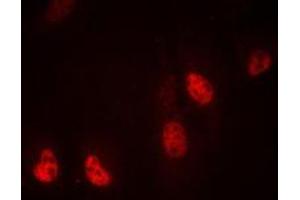 Immunofluorescent analysis of RPL36 staining in MDAMB435 cells. (RPL36 antibody  (Center))