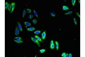 Immunofluorescent analysis of HepG2 cells using ABIN7161338 at dilution of 1:100 and Alexa Fluor 488-congugated AffiniPure Goat Anti-Rabbit IgG(H+L) (NMUR1 antibody  (AA 360-426))