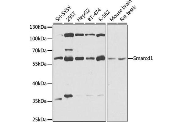 SMARCD1 抗体  (AA 1-120)