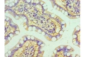 Immunohistochemistry of paraffin-embedded human small intestine tissue using ABIN7155973 at dilution of 1:100 (HYAL3 antibody  (AA 198-417))