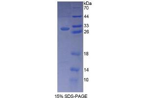 SDS-PAGE analysis of Human Bcl10 Protein.