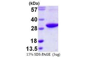 SDS-PAGE (SDS) image for RAB3D, Member RAS Oncogene Family (RAB3D) (AA 1-219) protein (His tag) (ABIN667481)