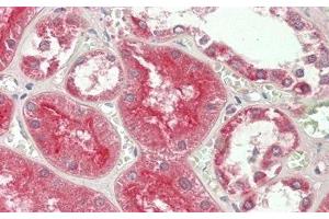 Immunohistochemistry (IHC) image for anti-ADAM Metallopeptidase Domain 10 (ADAM10) (AA 420-641) antibody (ABIN7432559)