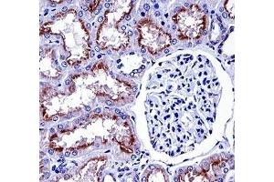 NOX4 antibody immunohistochemistry analysis in formalin fixed and paraffin embedded human kidney tissue. (NADPH Oxidase 4 antibody  (AA 124-153))