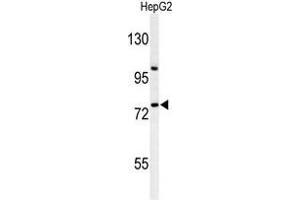 Western blot analysis of ZNF202 Antibody (Center) in HepG2 cell line lysates (35 µg/lane). (ZNF202 antibody  (Middle Region))