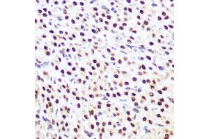 Immunohistochemistry of paraffin-embedded rat ovary using SP3 Rabbit pAb (ABIN6130701, ABIN6148314, ABIN6148315 and ABIN6216542) at dilution of 1:100 (40x lens). (Sp3 antibody  (AA 240-350))