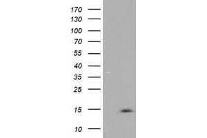Western Blotting (WB) image for anti-NADH Dehydrogenase (Ubiquinone) 1 alpha Subcomplex, 7, 14.5kDa (NDUFA7) antibody (ABIN1499663)