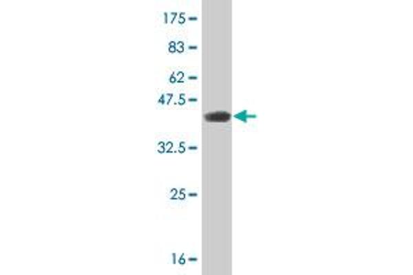 Retinoic Acid Receptor alpha antibody  (AA 315-424)