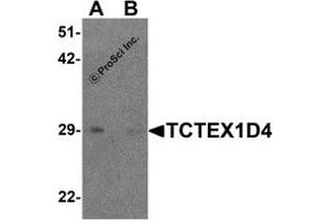 Western Blotting (WB) image for anti-Tctex1 Domain Containing 4 (TCTEX1D4) (N-Term) antibody (ABIN1587950) (TCTEX1D4 antibody  (N-Term))