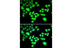 Immunofluorescence analysis of MCF-7 cells using RAD1 antibody (ABIN5995531). (RAD1 antibody)