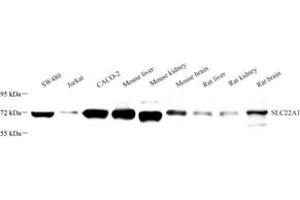 Western blot analysis of SLC22A1 (ABIN7075663) at dilution of 1: 1000 (SLC22A1 antibody)