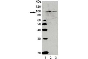 Western blot analysis of AhR, pAb : Lane 1: MW marker, Lane 2: Rat liver lysate, Lane 3: Mouse liver lysate. (Aryl Hydrocarbon Receptor antibody  (AA 1-402))