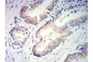 Immunohistochemical analysis of paraffin-embedded prostate tissues using PSAP mouse mAb with DAB staining. (Prosaposin antibody  (AA 17-216))