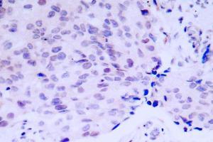 Image no. 2 for anti-Retinoblastoma 1 (RB1) antibody (ABIN271803) (Retinoblastoma 1 antibody)