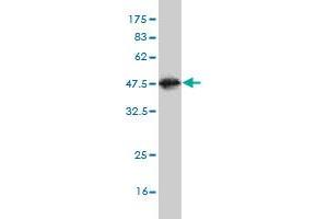 Western Blotting (WB) image for anti-Tissue Specific Transplantation Antigen P35B (TSTA3) (AA 222-321) antibody (ABIN563274)