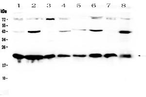 Western blot analysis of HP1 gamma using anti-HP1 gamma antibody . (CBX3 antibody  (AA 2-183))