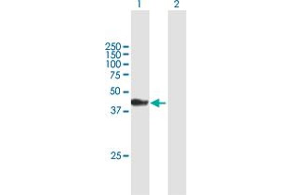 CARNS1 antibody  (AA 1-385)