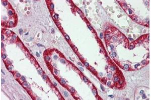 Human Kidney: Formalin-Fixed, Paraffin-Embedded (FFPE) (EIF3E antibody  (AA 36-85))
