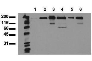 Western Blotting (WB) image for anti-Receptor Tyrosine-Protein Kinase ErbB-3 (ERBB3) (AA 1250-1270), (Cytoplasmic Domain) antibody (ABIN126794)