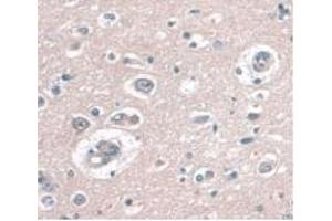 IHC-P analysis of Human Brain Tissue, with DAB staining. (CD34 antibody  (AA 32-290))