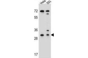 Western Blotting (WB) image for anti-Ephrin B2 (EFNB2) antibody (ABIN2996297) (Ephrin B2 antibody)