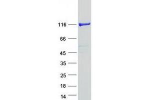 Validation with Western Blot (PHKB Protein (Transcript Variant 2) (Myc-DYKDDDDK Tag))