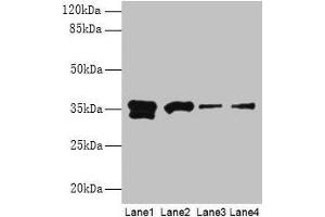 Western blot All lanes: APEX1 antibody at 2 μg/mL Lane 1: Hela whole cell lysate Lane 2: Mouse brain tissue Lane 3: MCF-7 whole cell lysate Lane 4: A431 whole cell lysate Secondary Goat polyclonal to rabbit IgG at 1/15000 dilution Predicted band size: 36 kDa Observed band size: 36 kDa (APEX1 antibody  (AA 32-318))