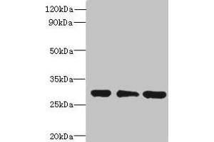 Western blot All lanes: HDHD3 antibody at 1 μg/mL Lane 1: Mouse small intestine tissue Lane 2: HT29 whole cell lysate Lane 3: COLO205 whole cell lysate Secondary Goat polyclonal to rabbit IgG at 1/10000 dilution Predicted band size: 28 kDa Observed band size: 28 kDa (HDHD3 antibody  (AA 1-251))