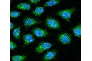 Anti-GAPDH antibody confocal immunofluorescent analysis with HeLa cell. (GAPDH antibody  (AA 62-91))