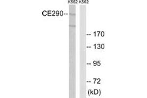 Western blot analysis of extracts from K562 cells, using CEP290 Antibody. (CEP290 antibody  (AA 771-820))