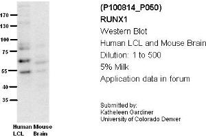 Image no. 3 for anti-Runt-Related Transcription Factor 1 (RUNX1) (Middle Region) antibody (ABIN2792598) (RUNX1 antibody  (Middle Region))
