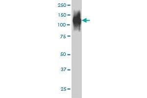 FAP monoclonal antibody (M01), clone 1E5 Western Blot analysis of FAP expression in HepG2 . (FAP antibody  (AA 525-624))