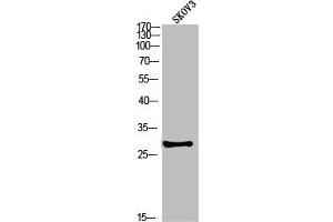 Western blot analysis of SKOV3 using p-PP2A-Cα (Y307) antibody. (PPP2CA antibody  (pTyr307))